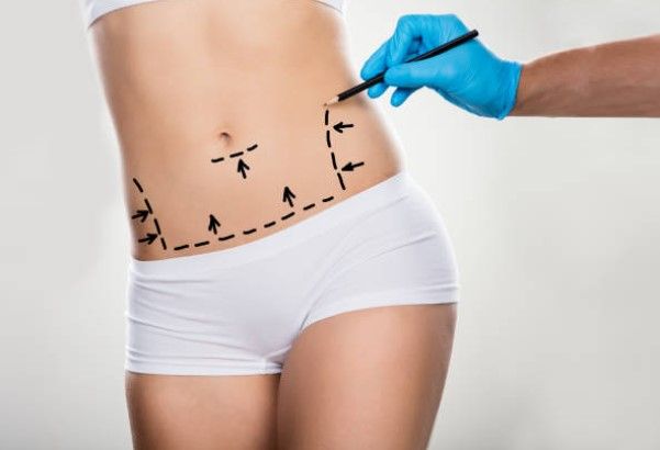 La chirurgie de la silhouette : Rajeunissez votre corps pour un avenir plus confiant
